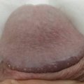 Cazzotosto