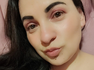 Kiss