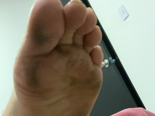 Dirty feet