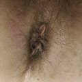 VitalyMeth1
