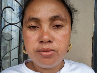 My Photos