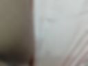 pubic hair