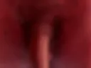 Darkkras