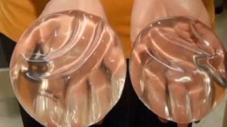 Silicone  implant