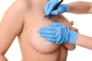 My dream is to have breast surgery and satisfy you