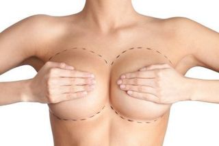 Tits