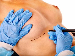 breast operation
